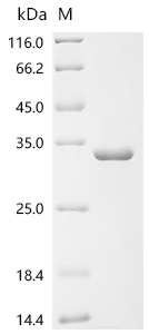 Recombinant Human Probable global transcription activator SNF2L2 (SMARCA2), partial