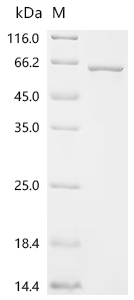Recombinant Human Arylsulfatase B (ARSB)