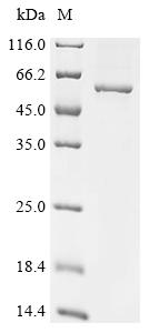 Recombinant Human T-complex protein 11-like X-linked protein 2 (TCP11X2)