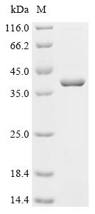 Recombinant Human Dead end protein homolog 1 (DND1)