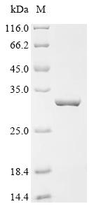 Recombinant Newcastle disease virus RNA-directed RNA polymerase L (L), partial