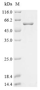 Recombinant Newcastle disease virus Phosphoprotein (P)