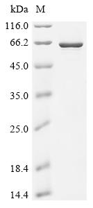 Recombinant Human Bifunctional arginine demethylase and lysyl-hydroxylase JMJD6 (JMJD6)