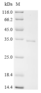 Recombinant Human Regulator of G-protein signaling 16 (RGS16)