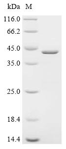 Recombinant Human G antigen 7 (GAGE7)