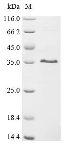 Recombinant Rat Matrix-remodeling-associated protein 7 (MXRA7), partial