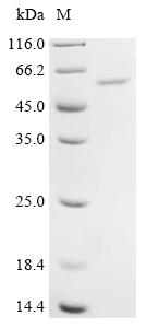 Recombinant Human Synaptic vesicle membrane protein VAT-1 homolog-like (VAT1L)
