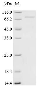 Recombinant Human YTH domain-containing family protein 2 (YTHDF2)