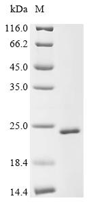 Recombinant Mouse Sorting nexin-32 (Snx32), partial