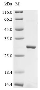 Recombinant Mouse Sorting nexin-32 (Snx32), partial