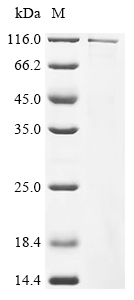Recombinant Mouse Dapper homolog 1 (Dact1)