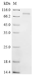 Recombinant Human E3 ubiquitin-protein ligase XIAP (XIAP)(E134D)