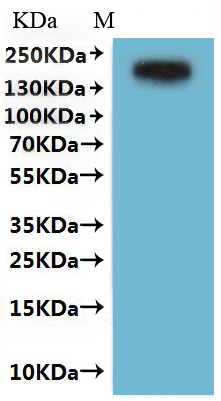 Recombinant Human Platelet glycoprotein 4 (CD36)-VLPs, Fluorescent