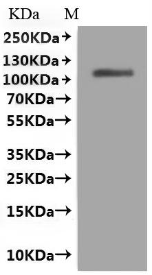 Recombinant Dog Folate hydrolase 1 (folh1), partial