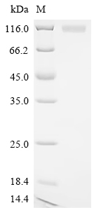Recombinant Pig Glutamate carboxypeptidase 2 (FOLH1), partial