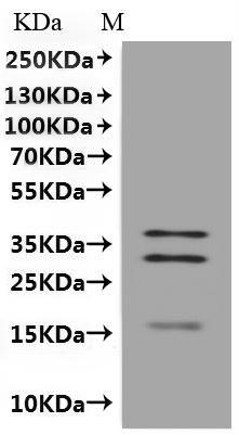 Recombinant Human Metalloreductase STEAP1 (STEAP1)-VLPs