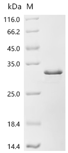 Recombinant Human Lysozyme C (LYZ)