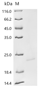 Recombinant Epstein-Barr virus Epstein-Barr nuclear antigen 1 (EBNA1), partial