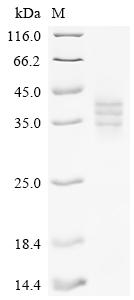 Recombinant Mouse Lymphocyte antigen 6D (Ly6d)