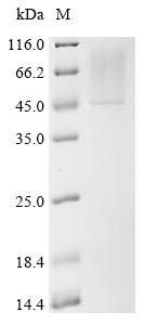 Recombinant Human Sialidase-2 (NEU2)
