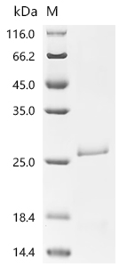 Recombinant Human Ras-related C3 botulinum toxin substrate 1 (RAC1)
