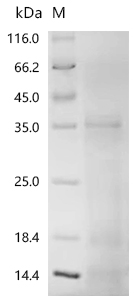 Recombinant Human Programmed cell death 1 ligand 1 (CD274) (K136A), partial