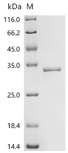 Recombinant Human Deoxyribonuclease-1-like 2 (DNASE1L2)