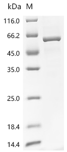 Recombinant Human Glucose-6-phosphate 1-dehydrogenase (G6PD)