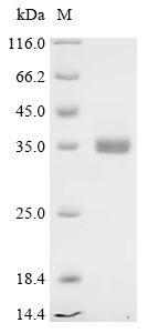 Recombinant Chicken Peptide YY-like (PYY)