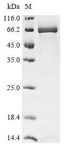Recombinant Rat Alpha-fetoprotein (Afp)