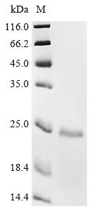 Recombinant Human Telomerase-binding protein EST1A (SMG6), partial