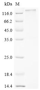 Recombinant Human Seizure 6-like protein (SEZ6L), partial