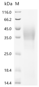 Recombinant Human LIM/homeobox protein Lhx3 (LHX3)