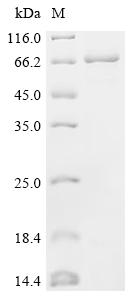Recombinant Human Glucose 1,6-bisphosphate synthase (PGM2L1)