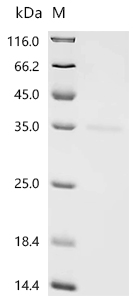 Recombinant Human Survival motor neuron protein (SMN1), partial