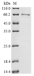 Recombinant Human Heterogeneous nuclear ribonucleoprotein K (HNRNPK), partial