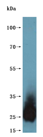 Recombinant Human Tetraspanin-8 (TSPAN8)-VLPs (Active)