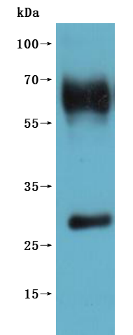 Recombinant Human G-protein coupled receptor 20 (GPR20)-VLPs (Active)