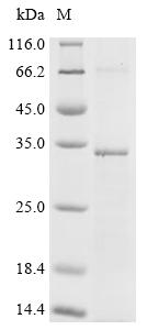 Recombinant Human Membrane progestin receptor alpha (PAQR7)