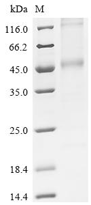 Recombinant Human Monocarboxylate transporter 4 (SLC16A3)