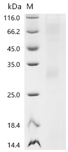 Recombinant Human Melanocortin receptor 3 (MC3R)