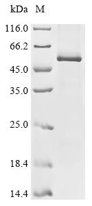 Recombinant Human Activin receptor type-1B (ACVR1B)