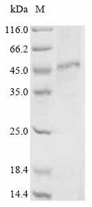 Recombinant Human Pyroglutamylated RF-amide peptide receptor (QRFPR)