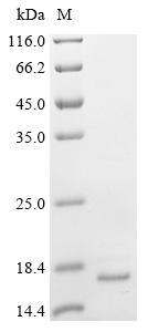 Recombinant Influenza B virus Matrix protein 2 (BM2) (I105V,R109H)