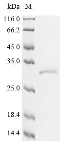Recombinant Human ADP/ATP translocase 1 (SLC25A4)