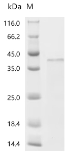 Recombinant Human metapneumovirus Major surface glycoprotein G (G), partial