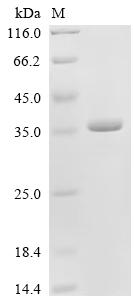 Recombinant Human Deleted in azoospermia-like (DAZL), partial