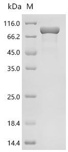 Recombinant Finegoldia magna ATCC 53516 LPXTG-motif cell wall anchor domain protein, partial, Biotinylated