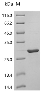 Recombinant Human Lipocalin-1 (LCN1)