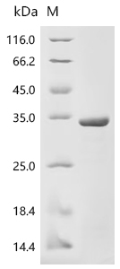 Recombinant Human Deoxyribonuclease-1 (DNASE1)